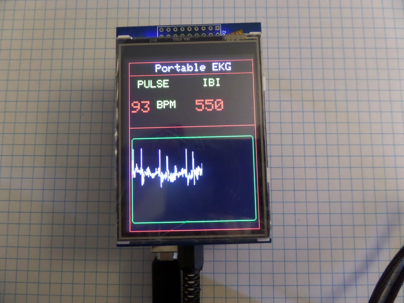 Arduino Portable EKG Monitor : 4 Steps (with Pictures) - Instructables