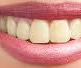 Clean Teeth Under 5 Minutes