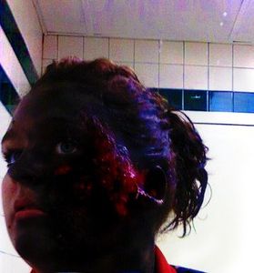 Burnt Face
