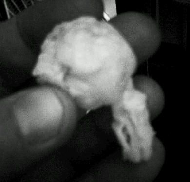 Mutant Eyeball and Stem (or Frog Brain)