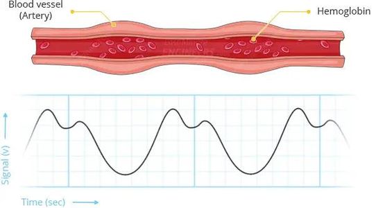 How Does a Pulse Sensor Work?