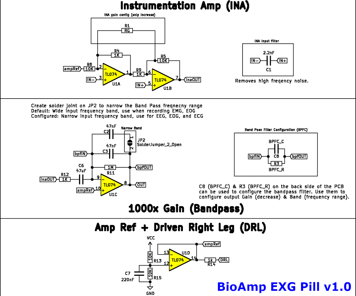 EMG With Arduino UNO R4 WiFi and DIY Neuroscience Kit From Upside Down ...