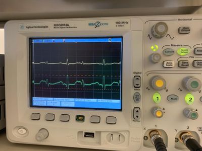 ECG Amplifier