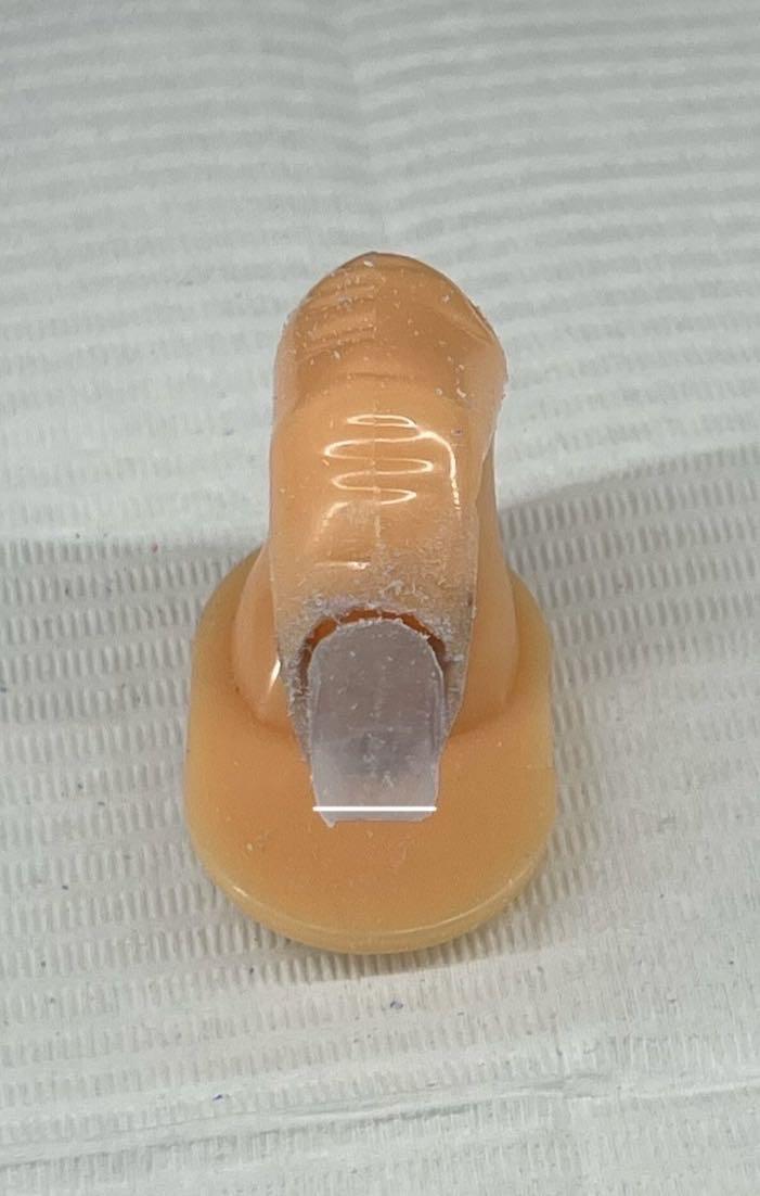 Shorten the Nail If Needed