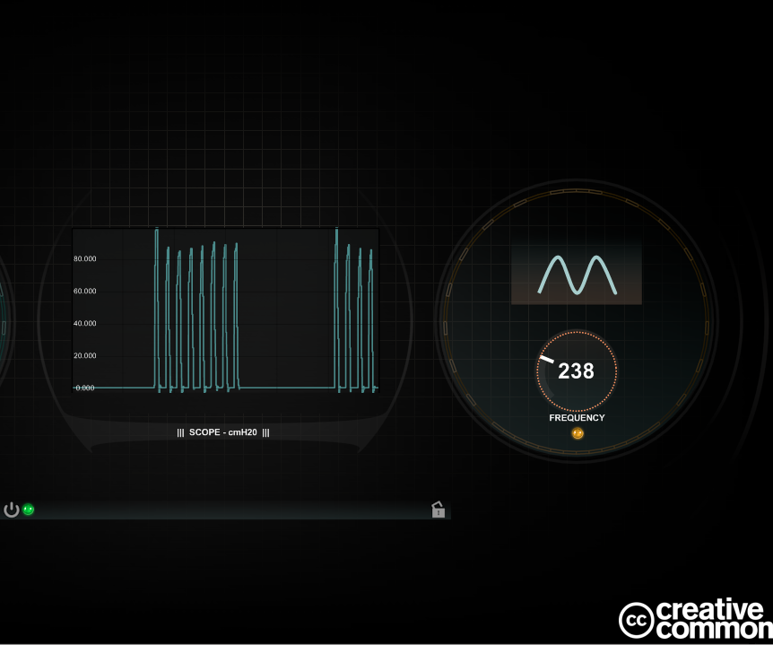 Ventilator Concept - High Frequency, Microprocessor Controlled, Pressure-limited