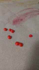 Ears, Eyes and Buttons