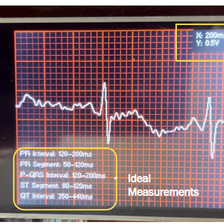 ECG Display With Arduino : 13 Steps (with Pictures) - Instructables