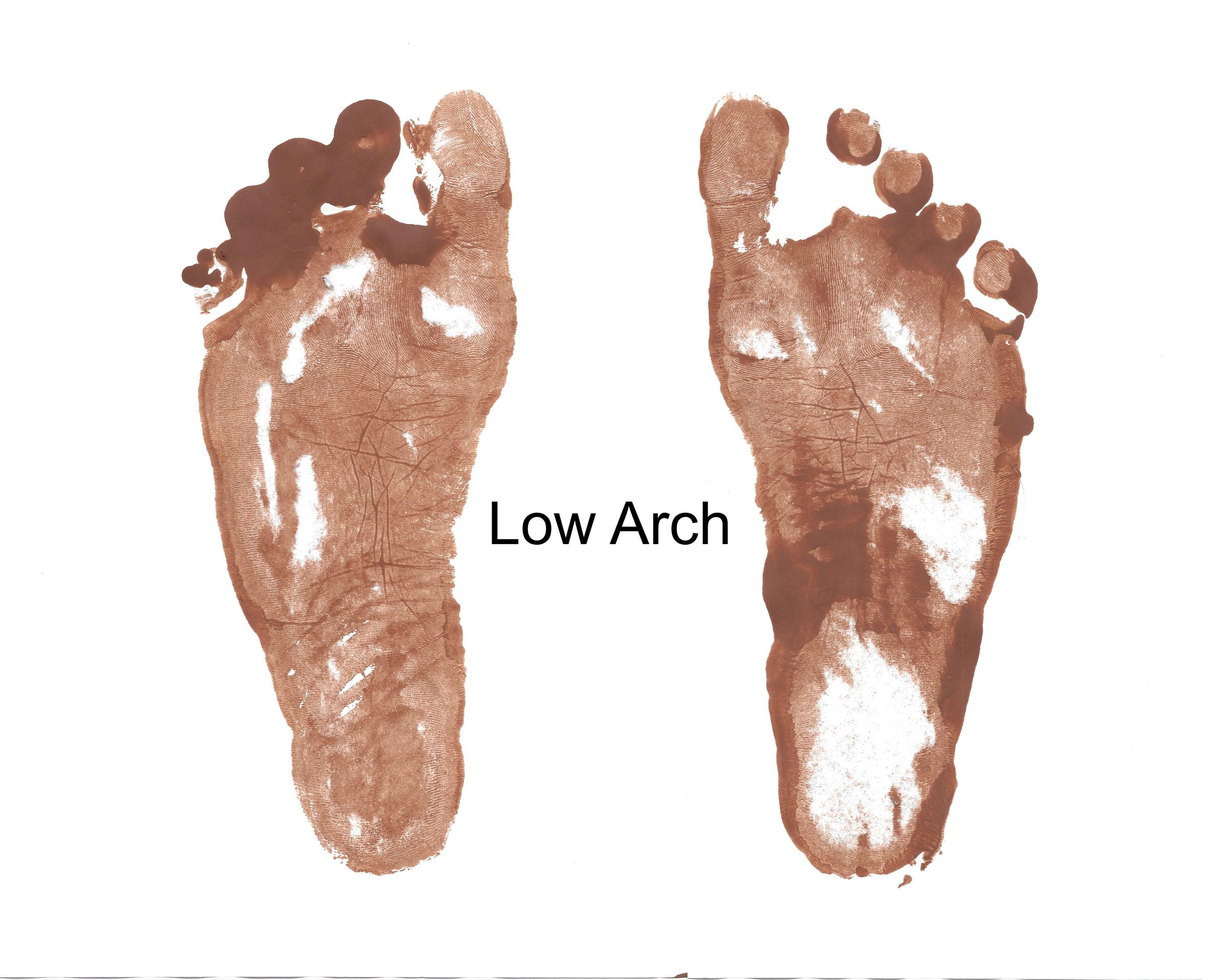 3D Print Custom Arch Supports 7 Steps (with Pictures) Instructables