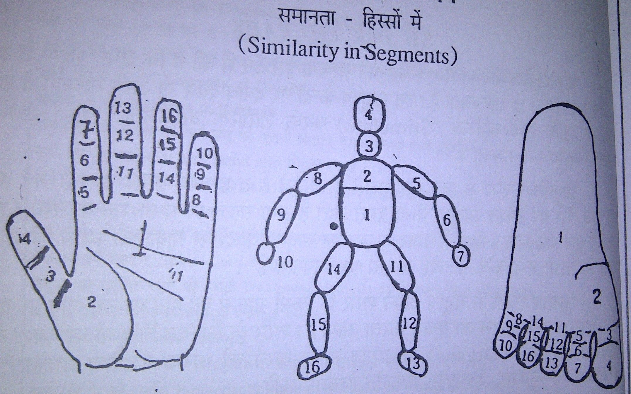 Body Pain Relief Therapy (Complete DIY ) - by a Successful Patient
