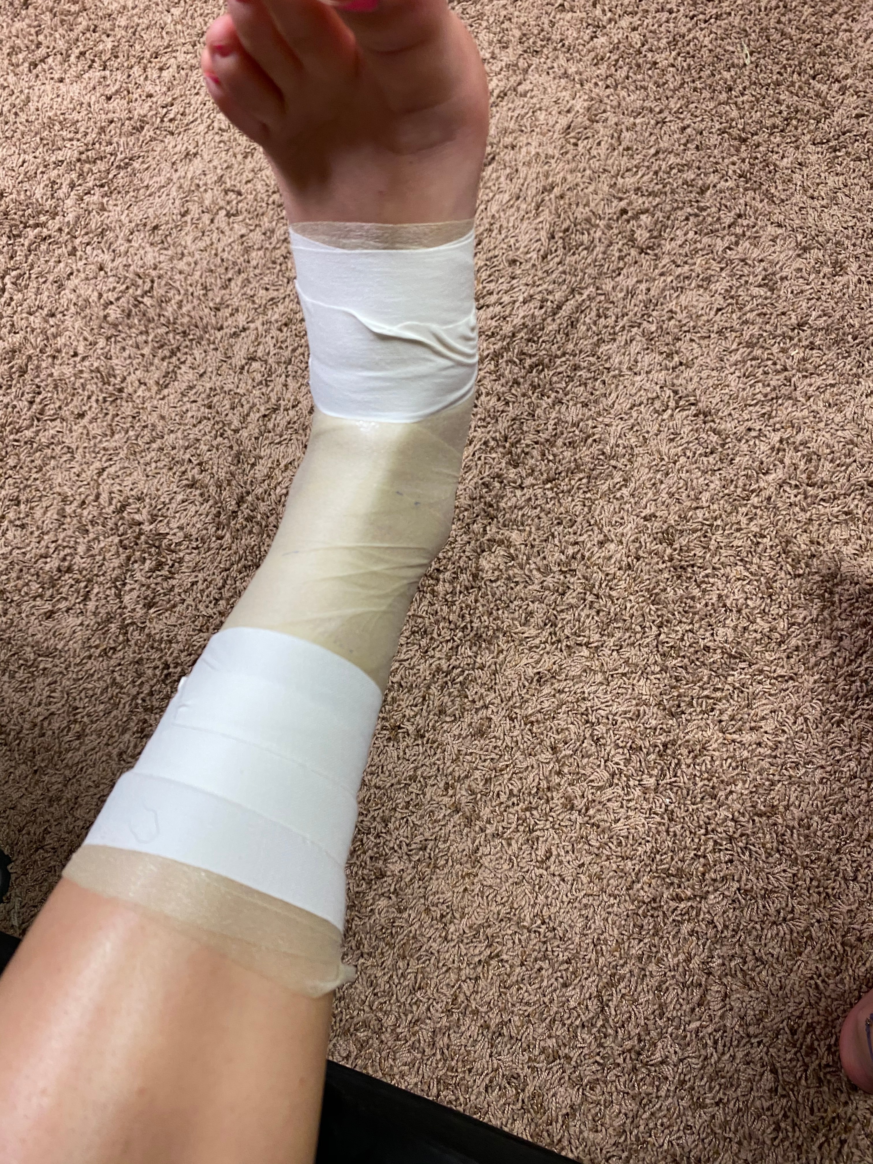 How to Tape an Ankle 6 Steps Instructables