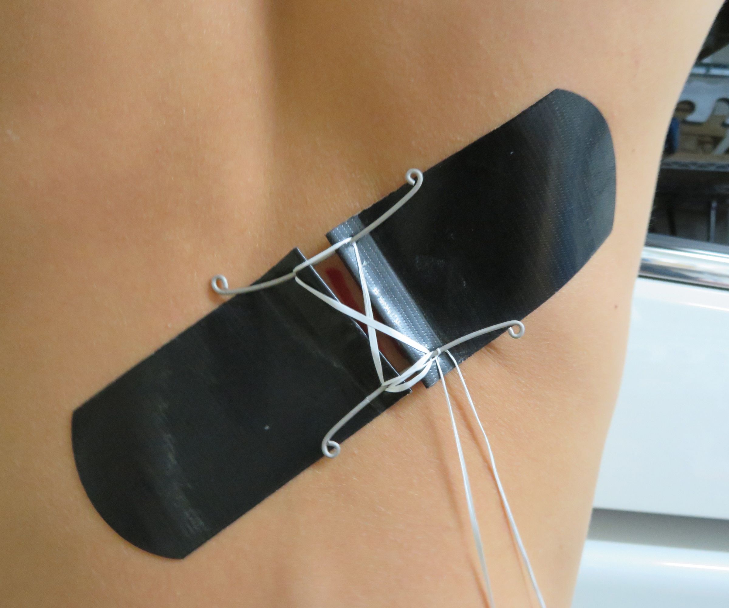 Ductanium Bandage