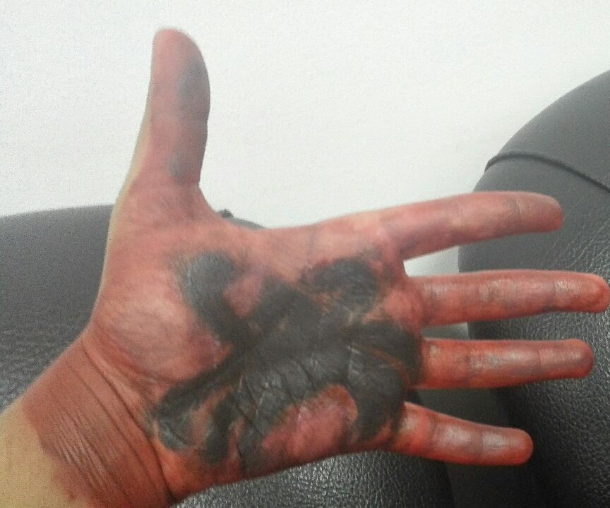 Bloody Spider