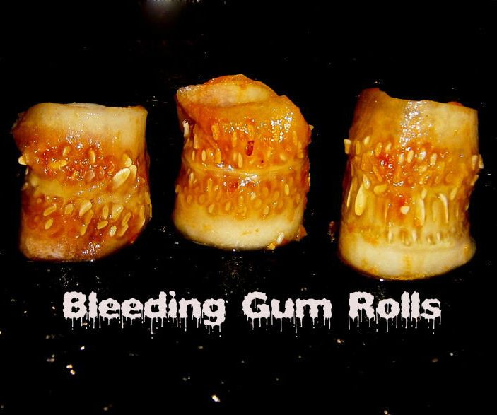 Bleeding Gum Rolls