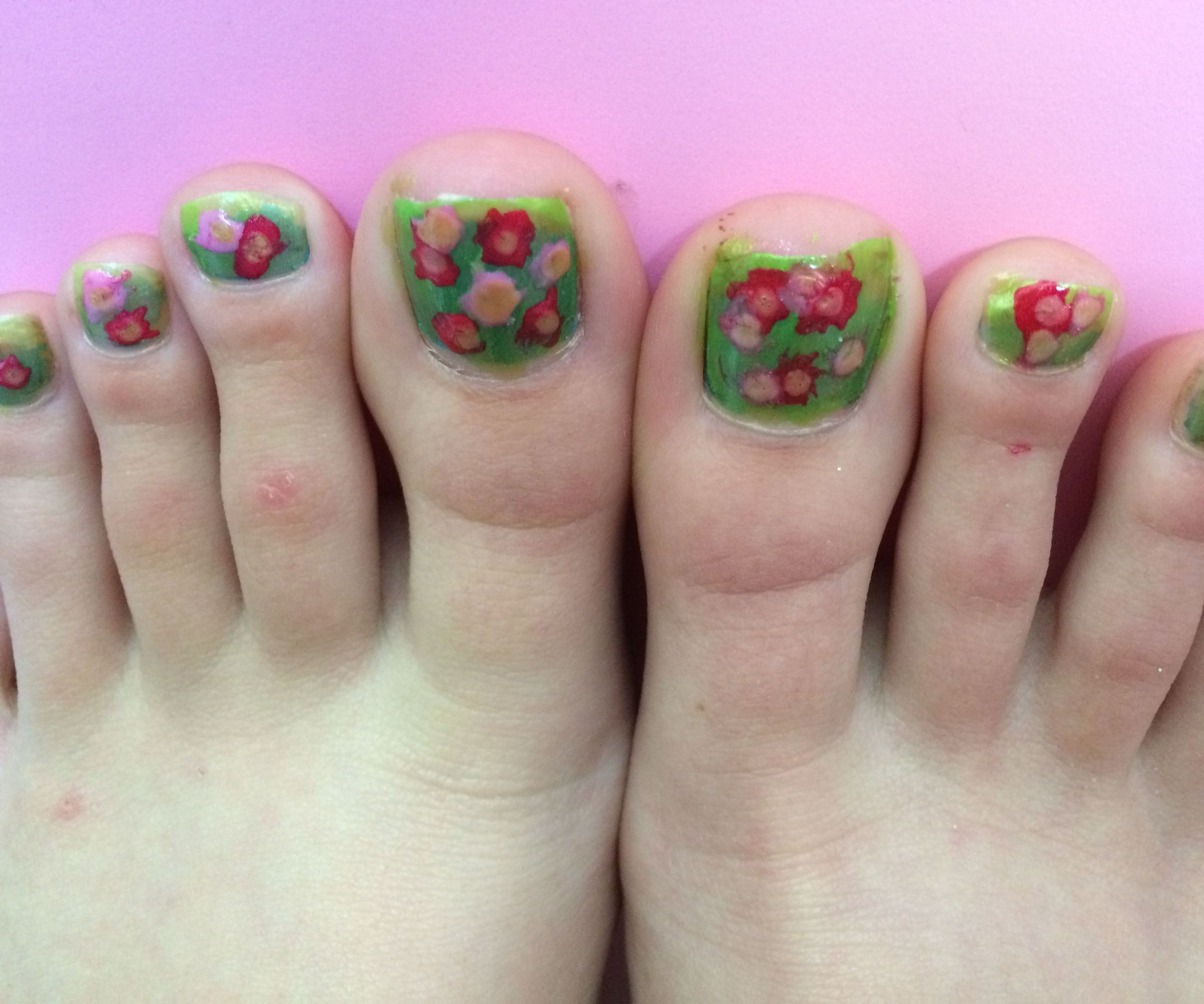 Rosy Toes!