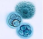 IVF Specializes Clinic Serves Patients From India to Accomplish the Goal to Remove