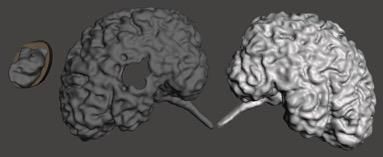 MRI to 3D Printable File : 14 Steps (with Pictures) - Instructables
