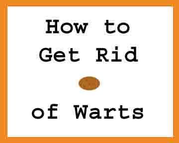 How to Get Rid of Warts