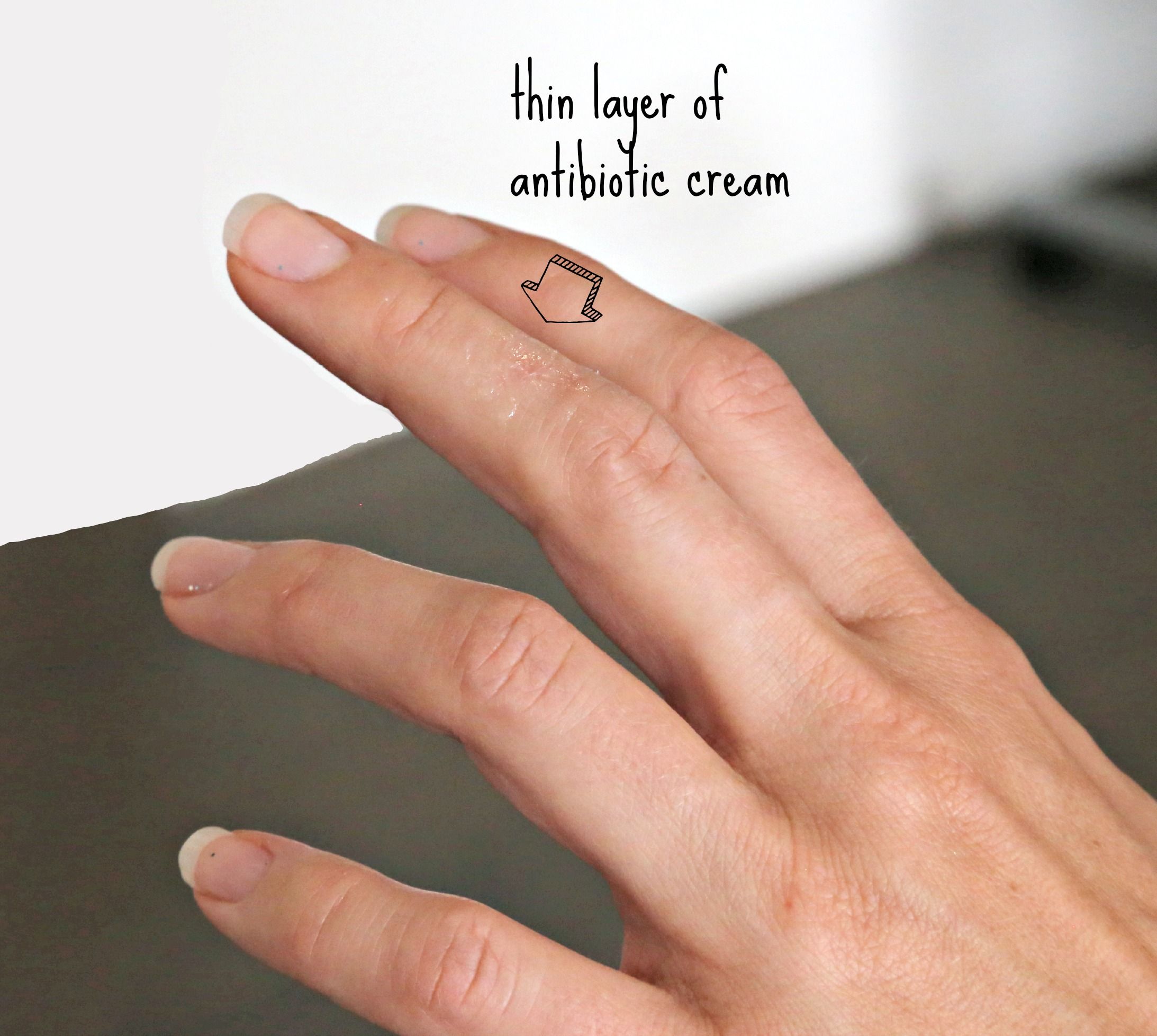 Disinfect a Cut 4 Steps (with Pictures) Instructables