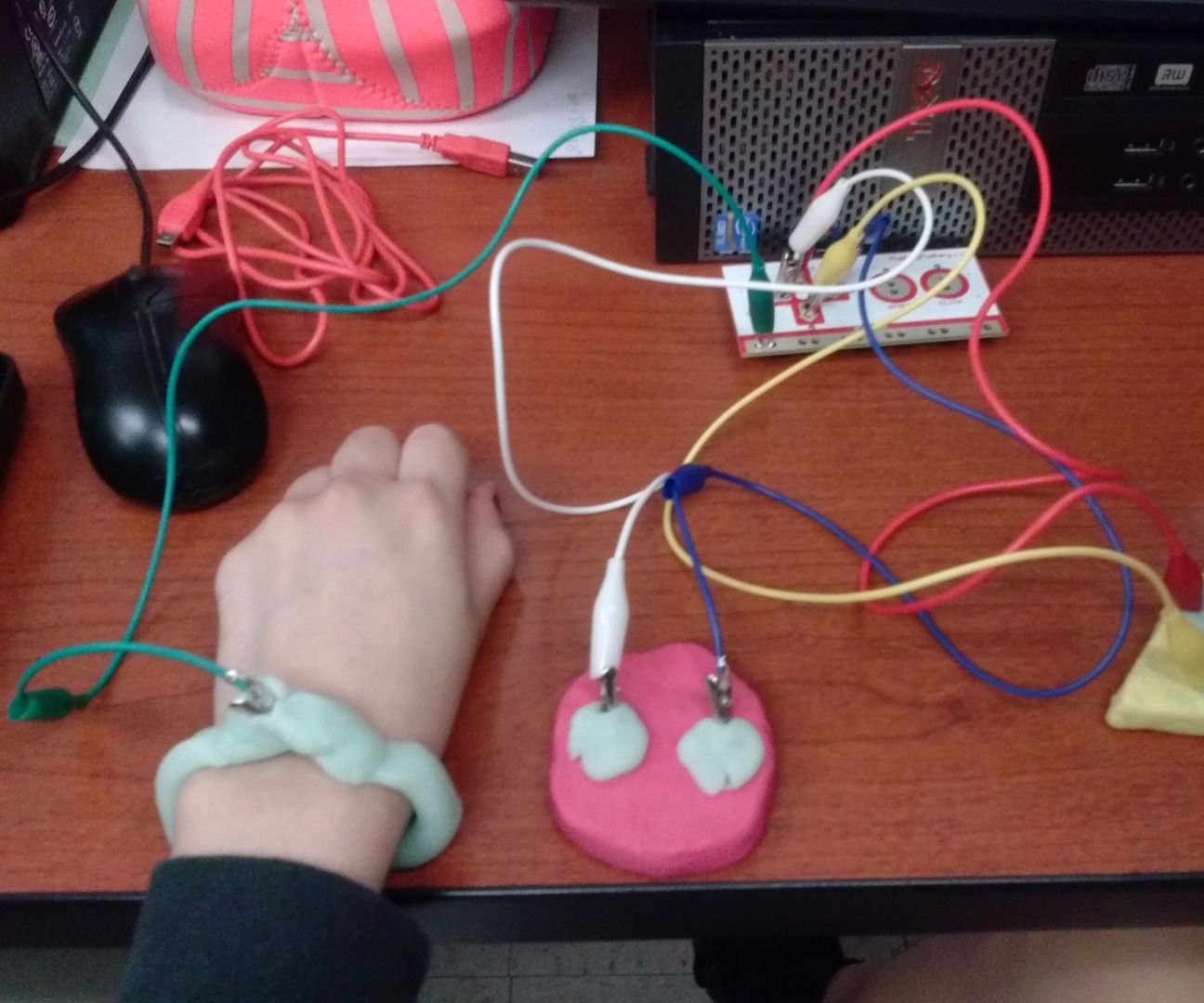 Makey Makey Remote Control for Juvenile Idiopathic Arthritis 
