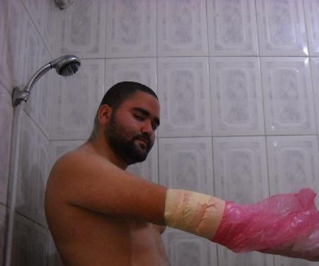 How to take A SHOWER with a Orthopedic cast