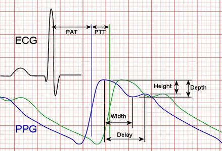 Arduino Ppg ECG With PPG Using Arduino : 9 Steps (with Pictures) - Instructables