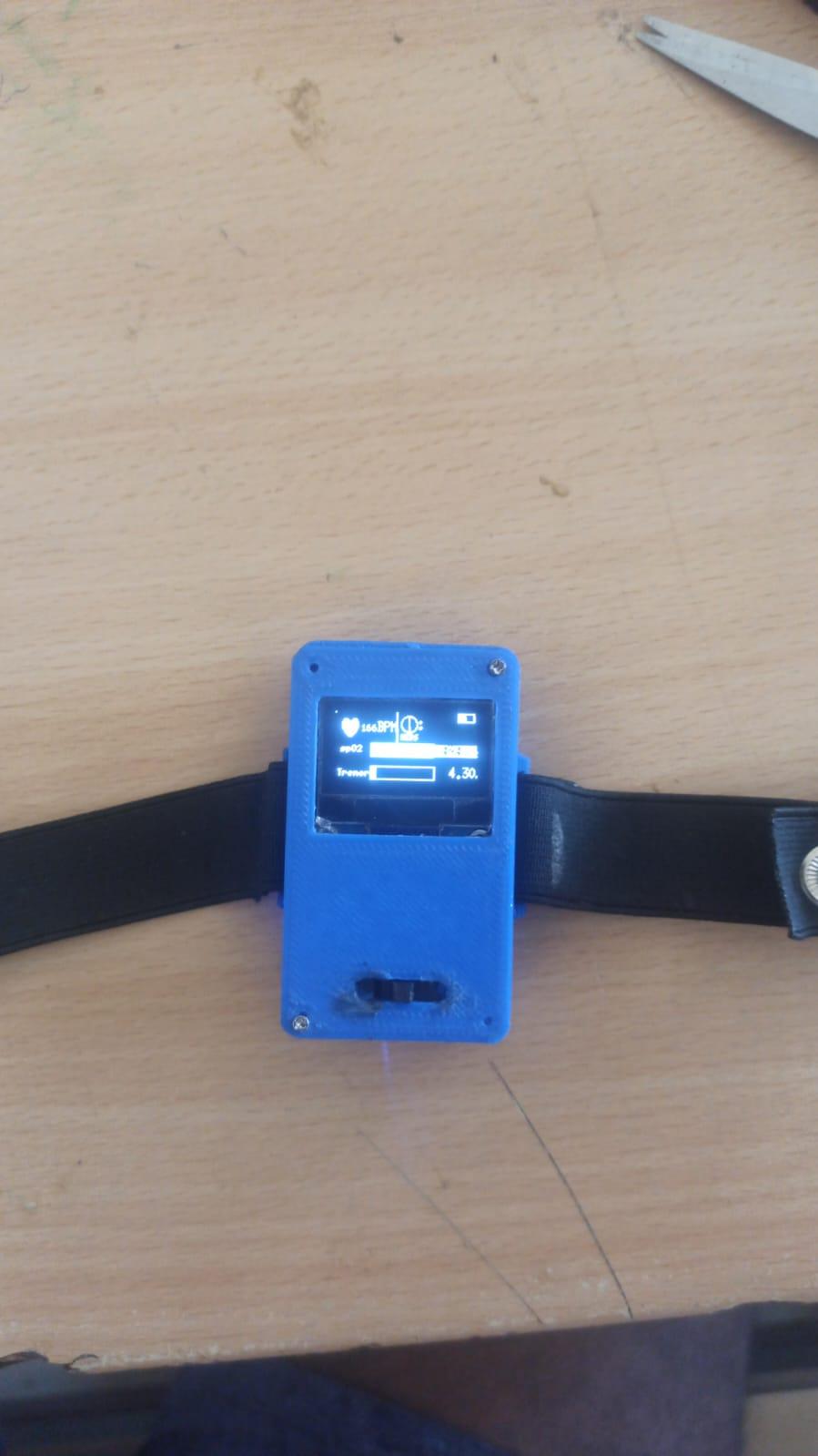 MediPulse-Wearable Device for Real-Time Monitoring of Parkinson's Disease