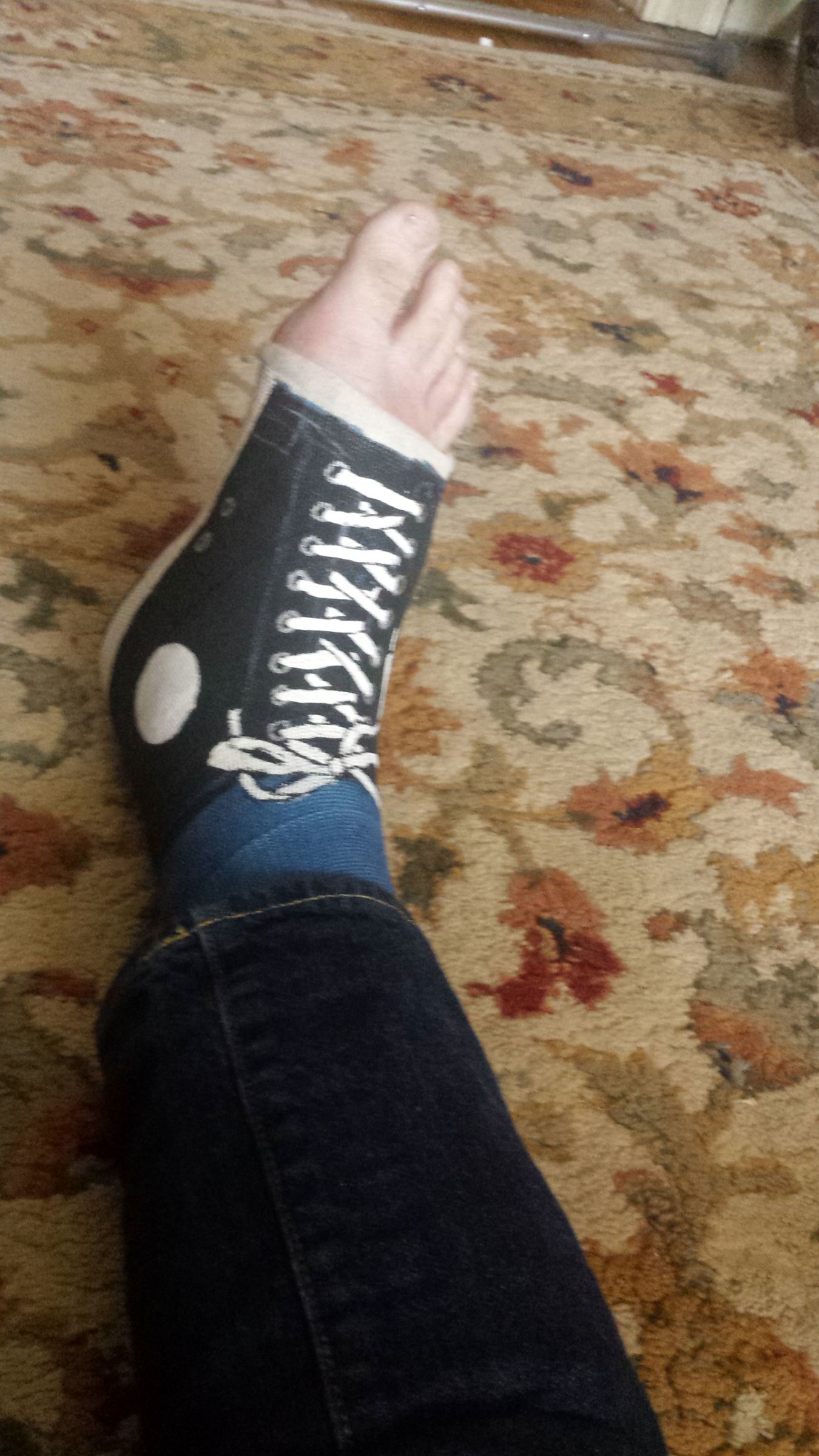 Peg Leg From Old Crutches 7 Steps Instructables