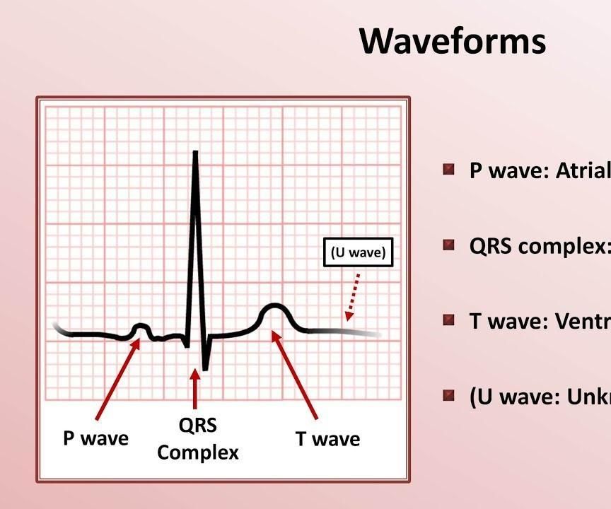 Simulated ECG Circuit