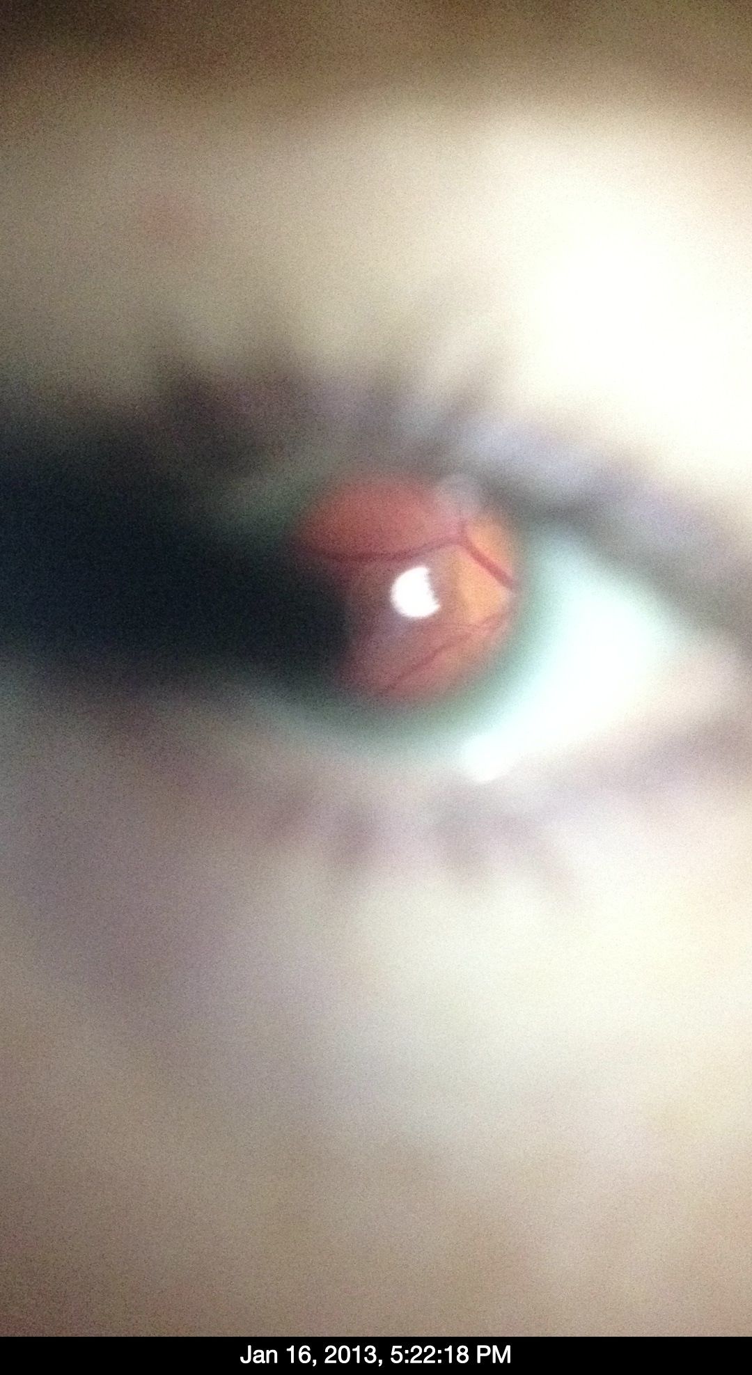 Easy Iphone to Direct Ophthalmoscope Conversion