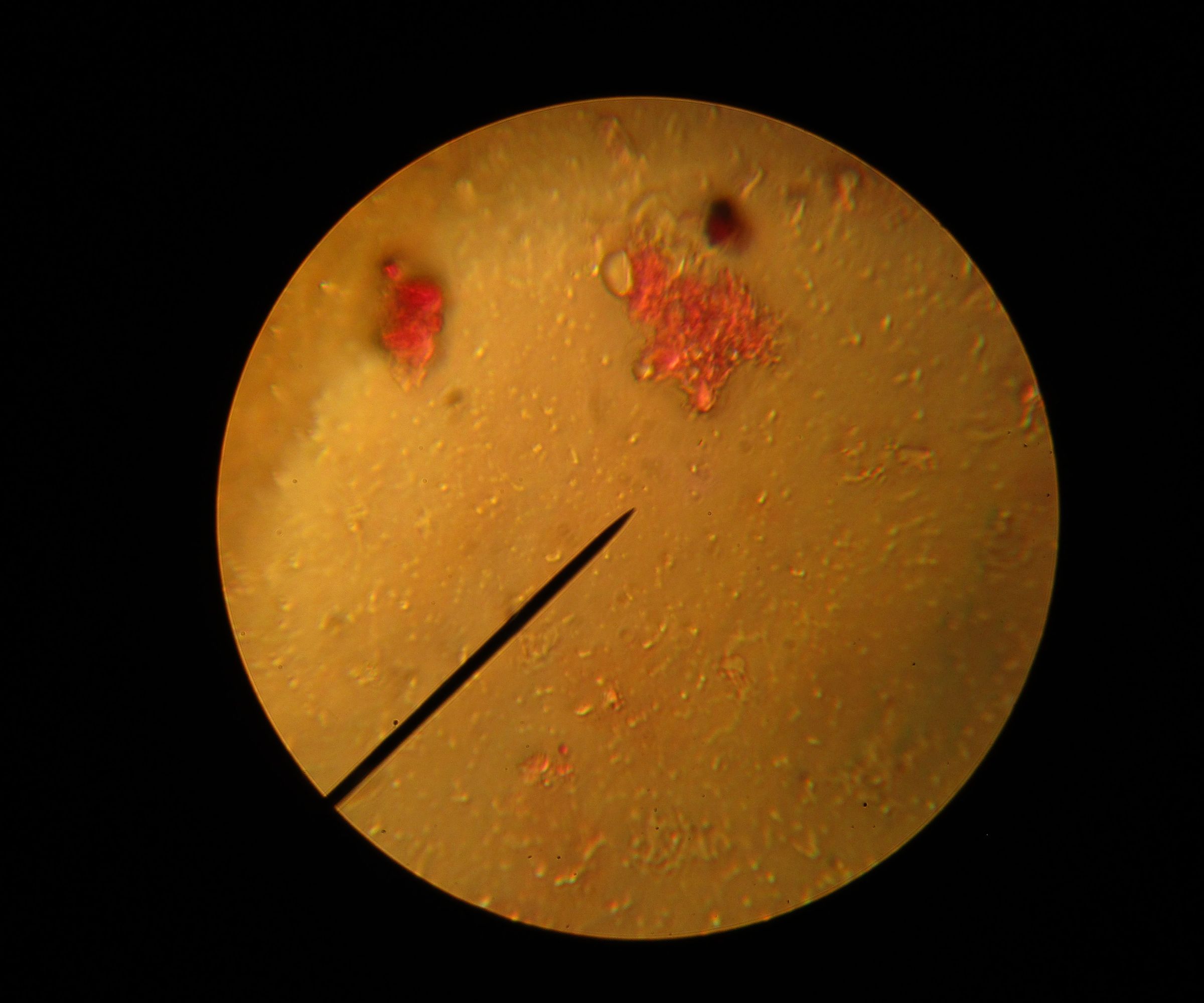 Seeing Spores From Bacteria With an Polarized Microscope!