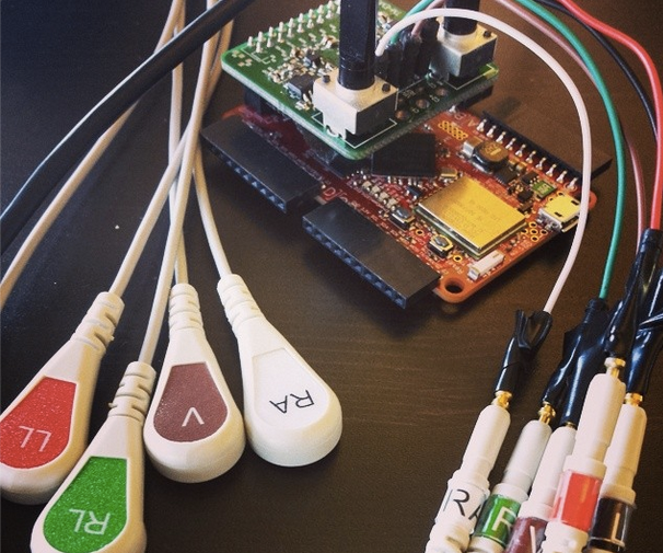 DIY Electromyography