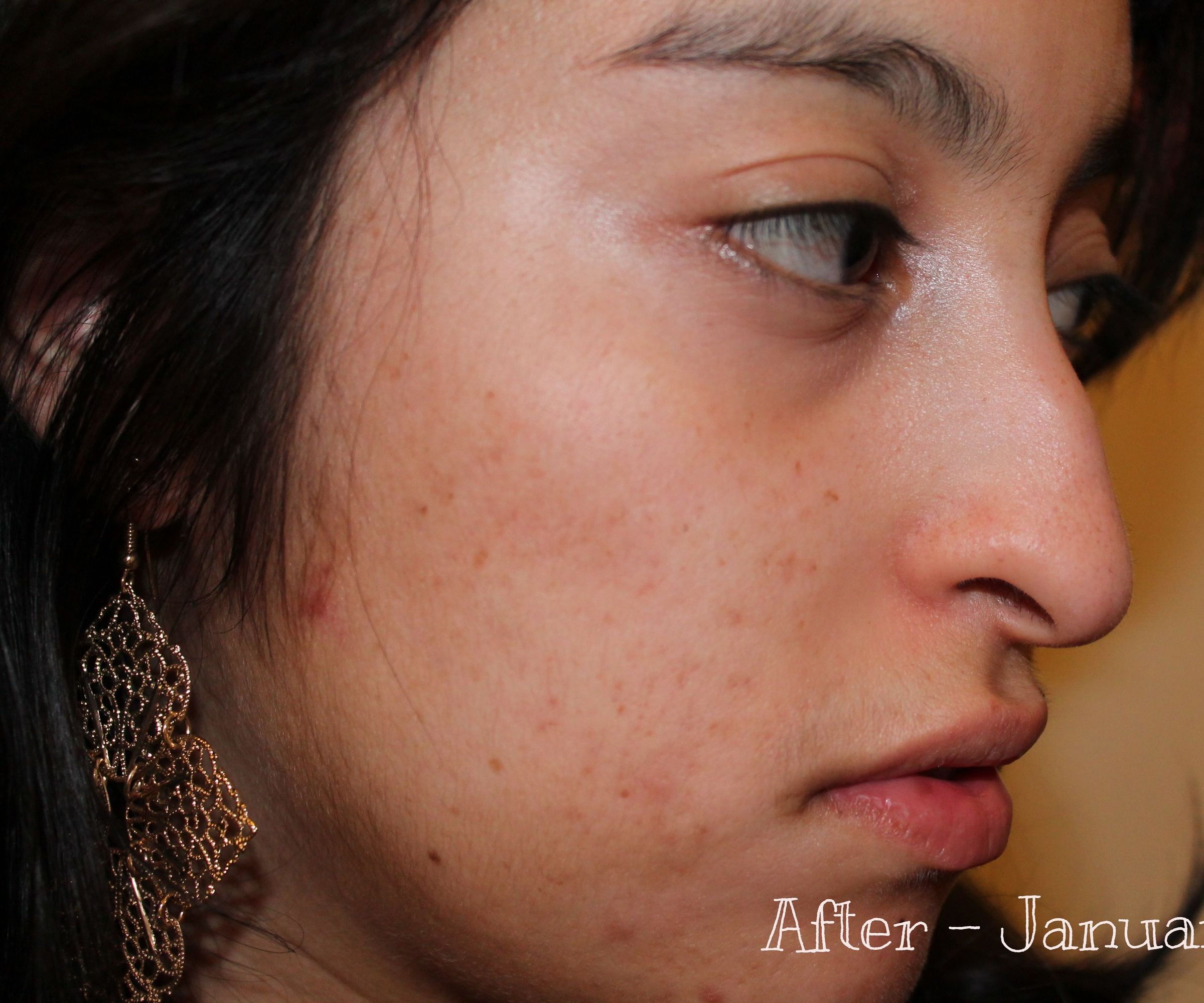 Features and Benefits of Dark Spot Corrector Lotion.