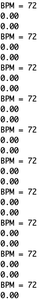 ECG Signal Plotting and Automatic BPM Readout on Arduino