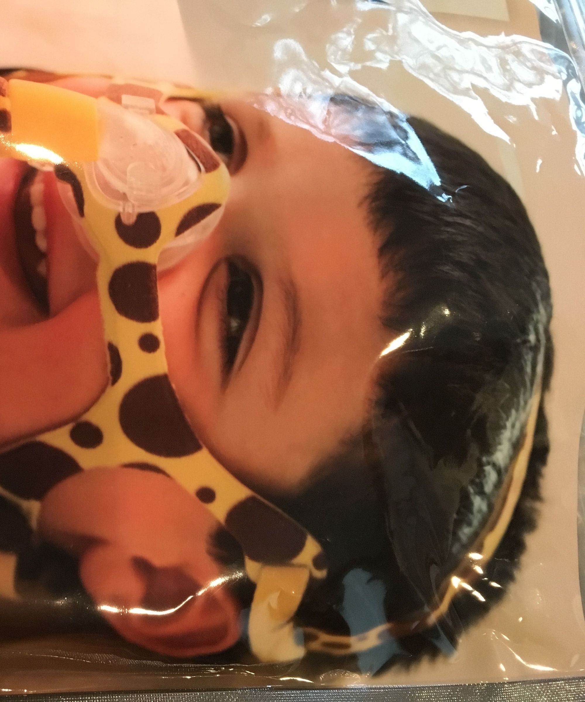 DIY BiPap Mask From a Wisp 