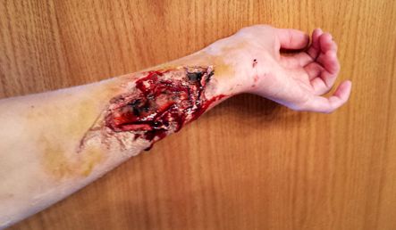 *BONUS: But Wait There's More! Bruising!