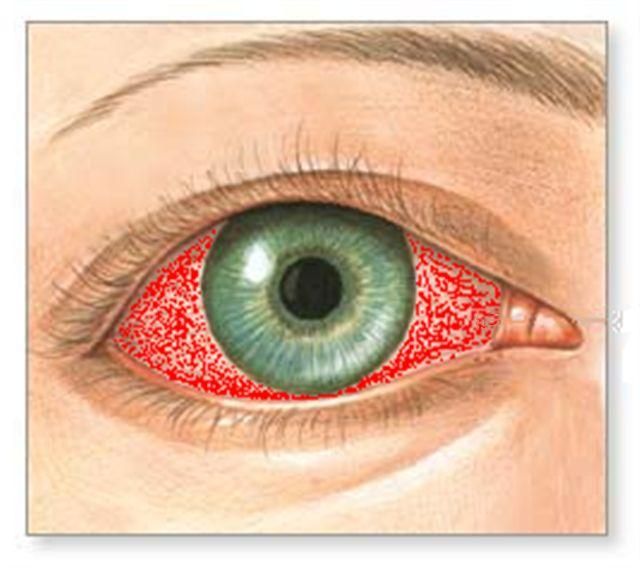 Emergency Face Shield