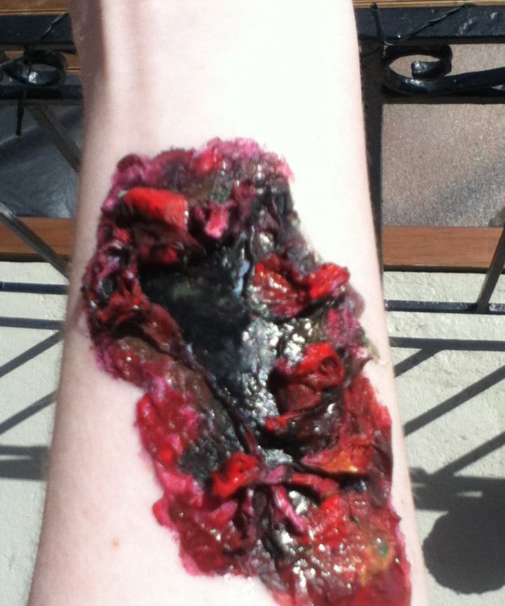 Zombie Wound #2