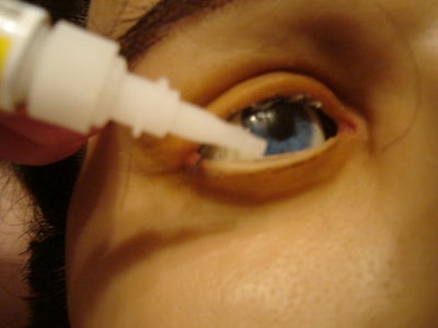 Glueing the Skin Back On