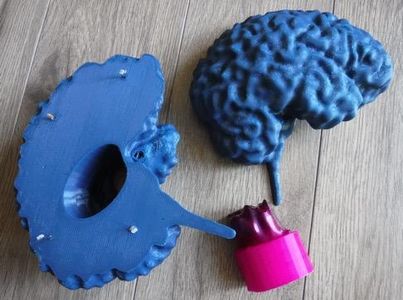 MRI to 3D Printable File : 14 Steps (with Pictures) - Instructables