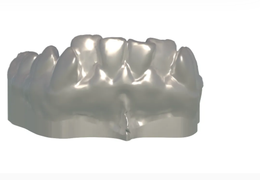 How to Add a Smooth Base to a Dental Model Using 3D CAD Software