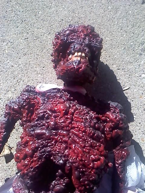 How to make a burn victim