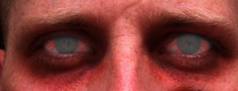 Step Ten: Vein Those Eyes.
