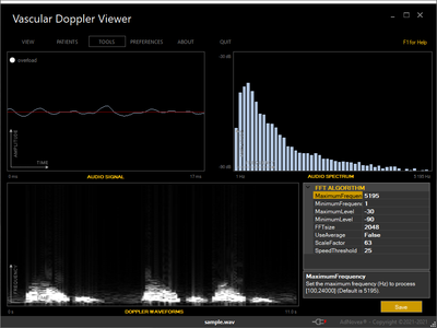 Vascular Doppler Viewer - Low Cost Blood Flow Speed Measure