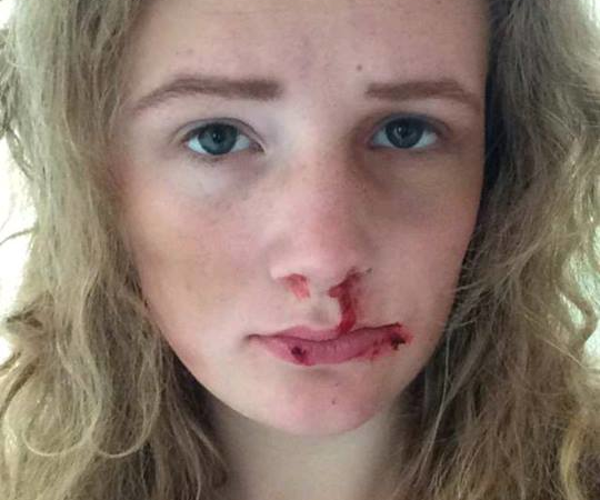 Makeup: a Black Eye and a Beaten Face