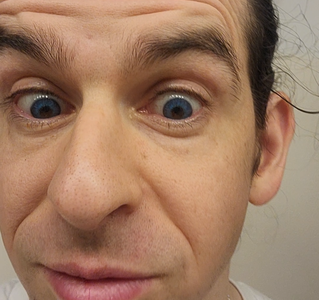 Inserting Blue Contact Lenses (optional)