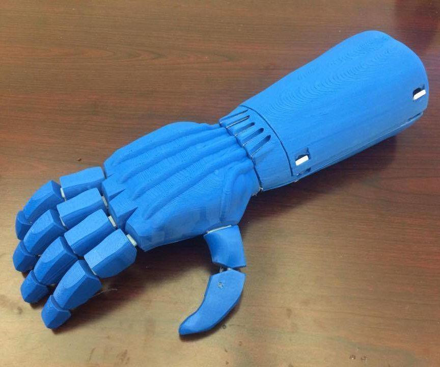 Streamlined 3D Printed Prosthetic Hand