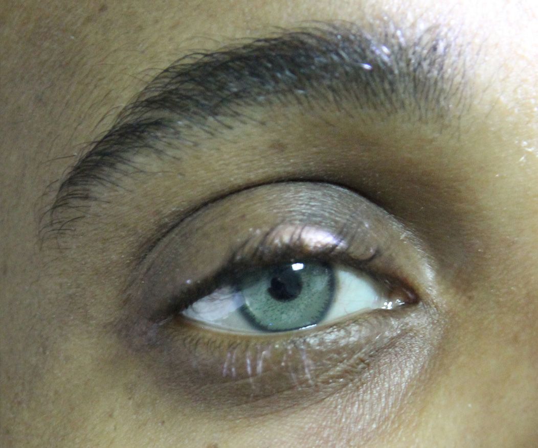 Change Your Iris Color With the Help of the Veteran Eye Surgeons