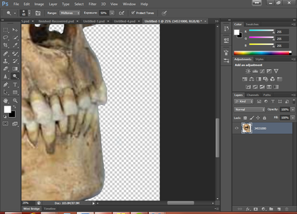 The Skull, Wound and the Spine