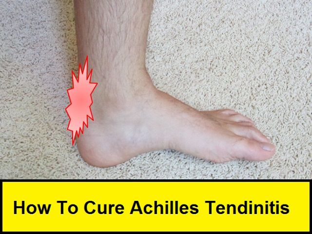 How to Cure Achilles Tendinitis