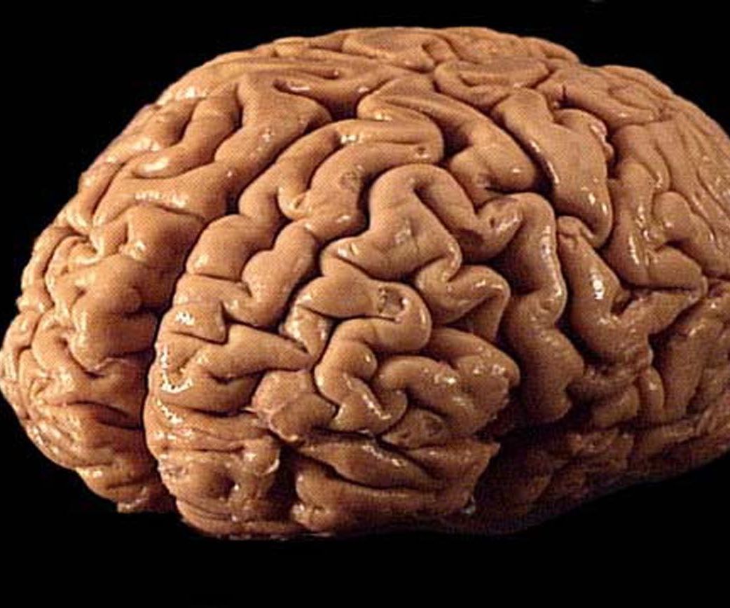 How to Play With Your Mind